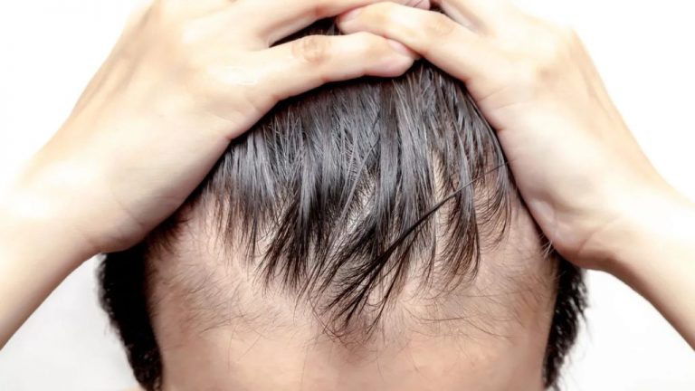 Right Hair Loss Treatment Creates Enhanced Appeal