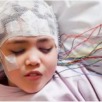 Epilepsy Here is A Guide To Treatment And Diagnosis