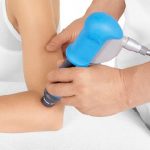 Prevalence Of Shockwave Therapy For Osteoarthritis