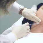 The Most Important Advantages of Double Chin Treatment