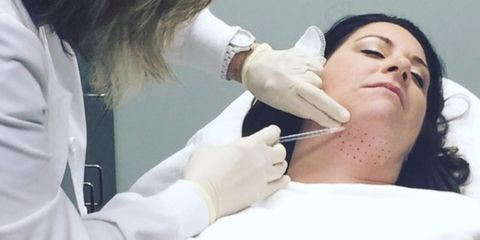 The Most Important Advantages of Double Chin Treatment