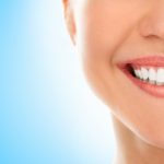 What Is Teeth Whitening?