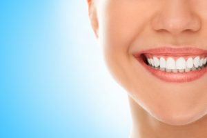 What Is Teeth Whitening?