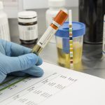 Cannabis Drug Test